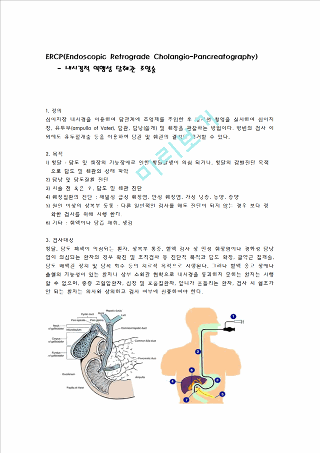 [간호학]ERCP(내시경적 역행성 담췌관 조영술)   (1 페이지)